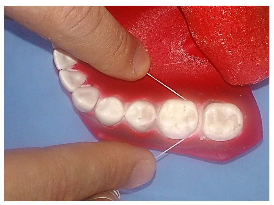 Passar Fio Dental Dentes Posteriores