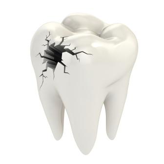 Trauma Dental