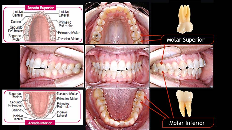 Quais dentes temos Dentes molares