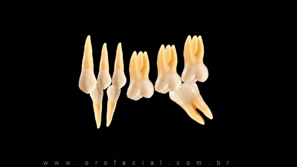 Ausência dentes Extrusão dente Ortodontia Aparelho para corrigir dentes