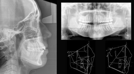 Orofacial #44 – Documentação para Ortodontia: Para que Serve?