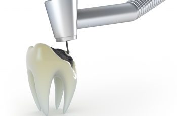 Orofacial #62 – Pivô X Coroa Dental Total (“jaqueta”) X Coroa Dental Parcial X Restauração (“Obturação”) do Dente